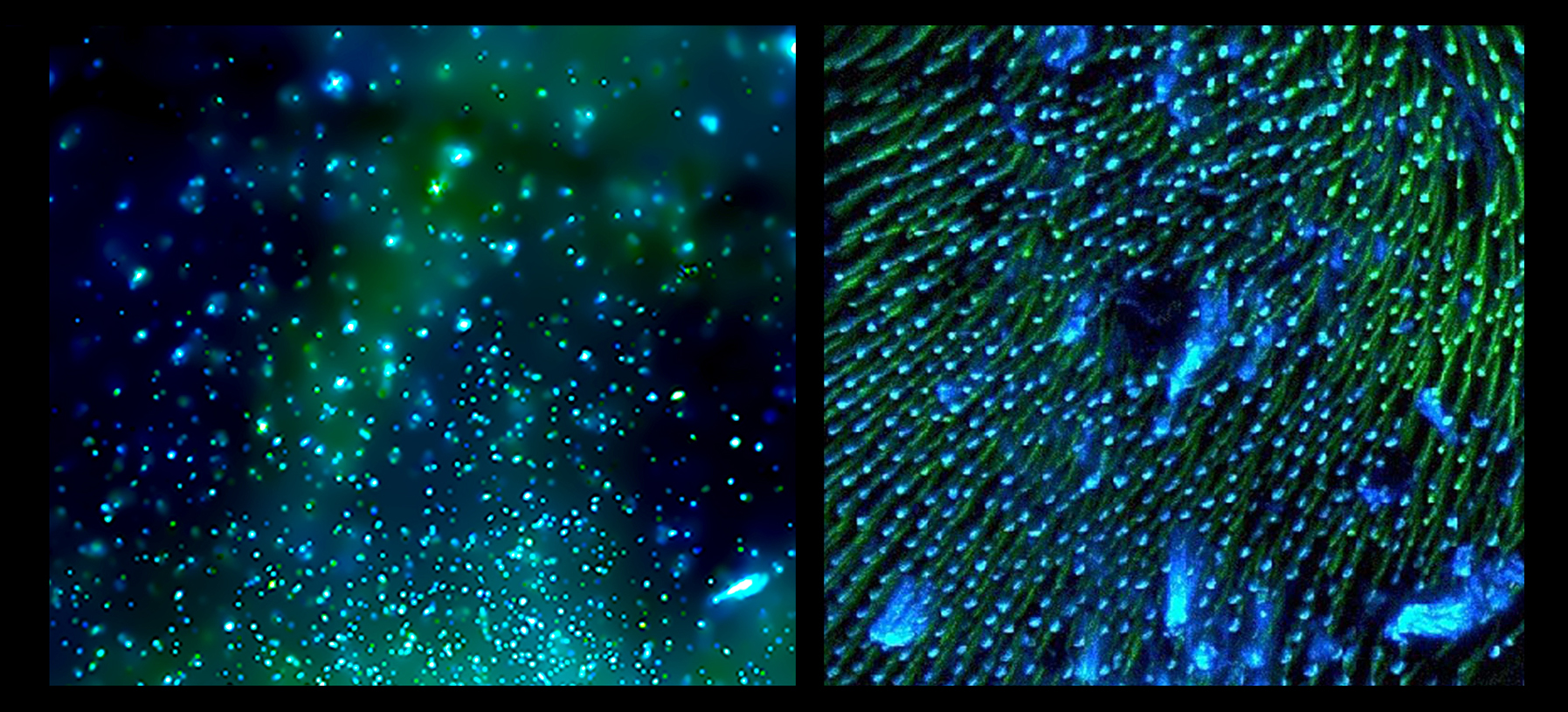 Star Cluster  vs. Ladybug Leg