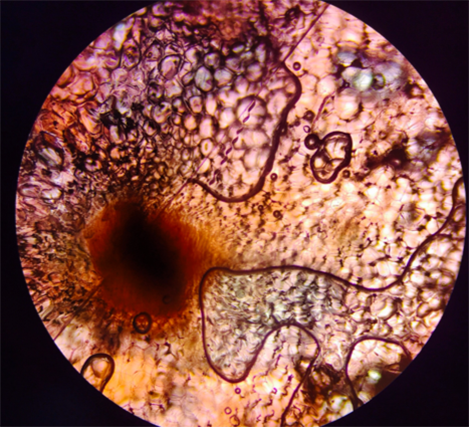 Onion Cells