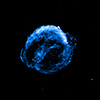 X-ray image