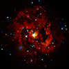 X-ray image
