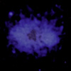 X-ray image